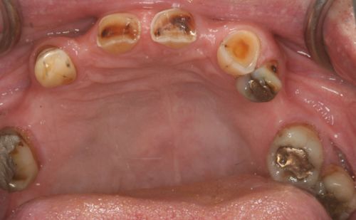 Before - Harcourt Dental Clinic