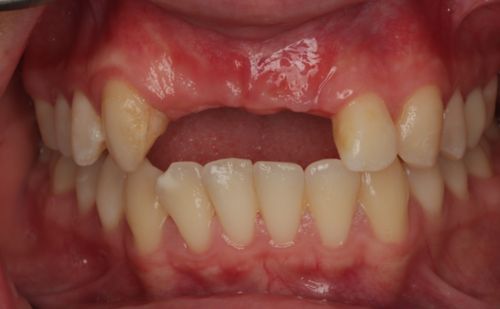 Before - Harcourt Dental Clinic