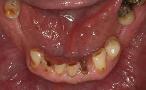 Before - Harcourt Dental Clinic