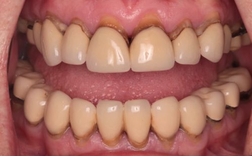 Before - Harcourt Dental Clinic