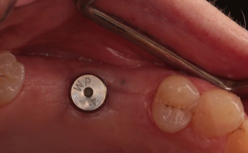 Before - Harcourt Dental Clinic