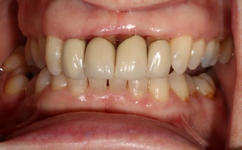 Before - Harcourt Dental Clinic