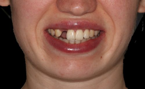 Before - Harcourt Dental Clinic