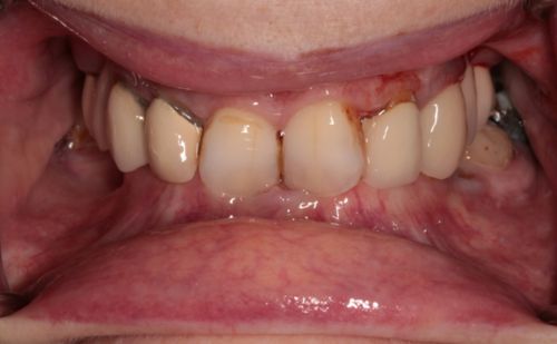 Before - Harcourt Dental Clinic