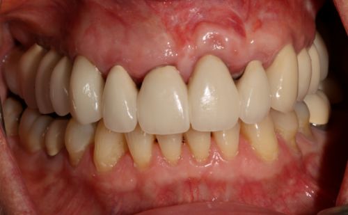 Before - Harcourt Dental Clinic