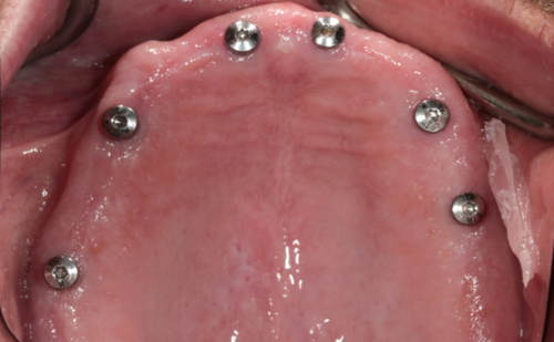 Before - Harcourt Dental Clinic