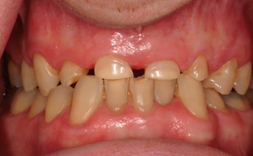 Before - Harcourt Dental Clinic