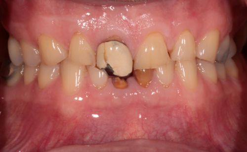 Before - Harcourt Dental Clinic