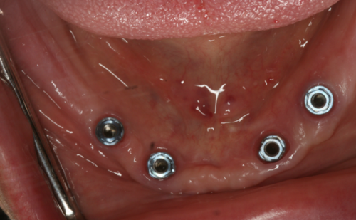 Before - Harcourt Dental Clinic