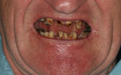 Before - Harcourt Dental Clinic