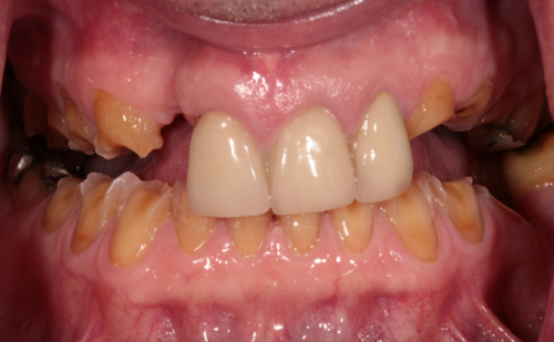 Before - Harcourt Dental Clinic