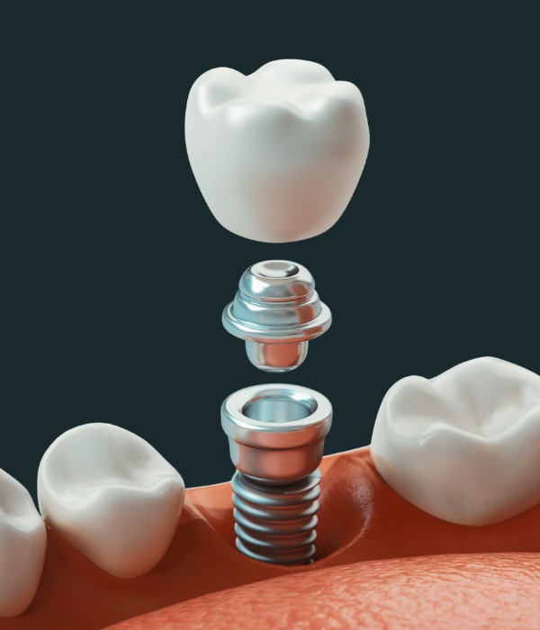 Treatment -  Harcourt Dental Clinic