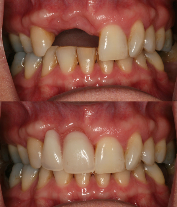 Treatment -  Harcourt Dental Clinic