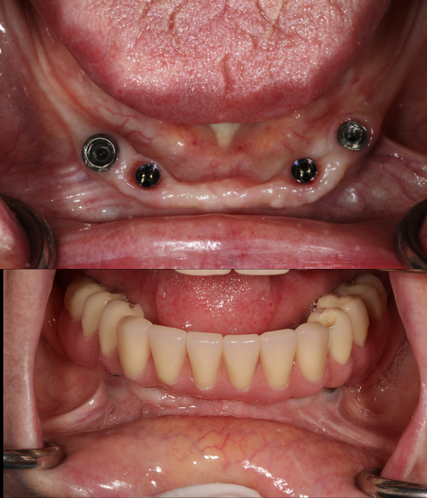 Treatment -  Harcourt Dental Clinic