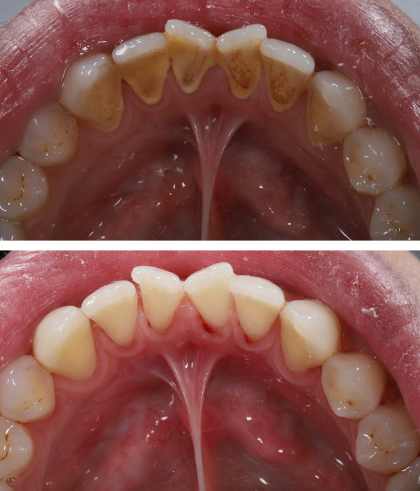 Treatment -  Harcourt Dental Clinic